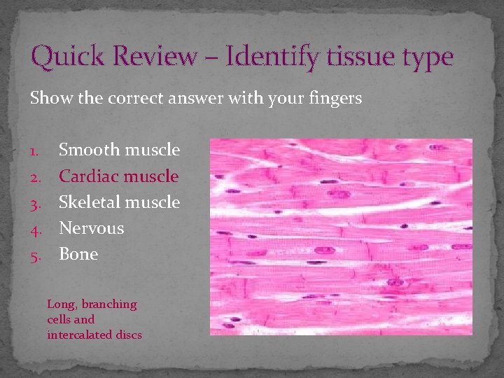 Quick Review – Identify tissue type Show the correct answer with your fingers 1.