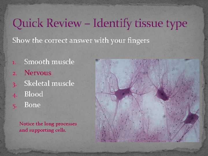 Quick Review – Identify tissue type Show the correct answer with your fingers 1.