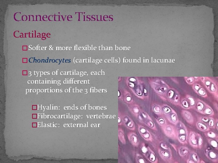 Connective Tissues Cartilage � Softer & more flexible than bone � Chondrocytes (cartilage cells)