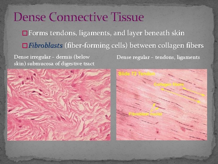 Dense Connective Tissue � Forms tendons, ligaments, and layer beneath skin � Fibroblasts (fiber-forming