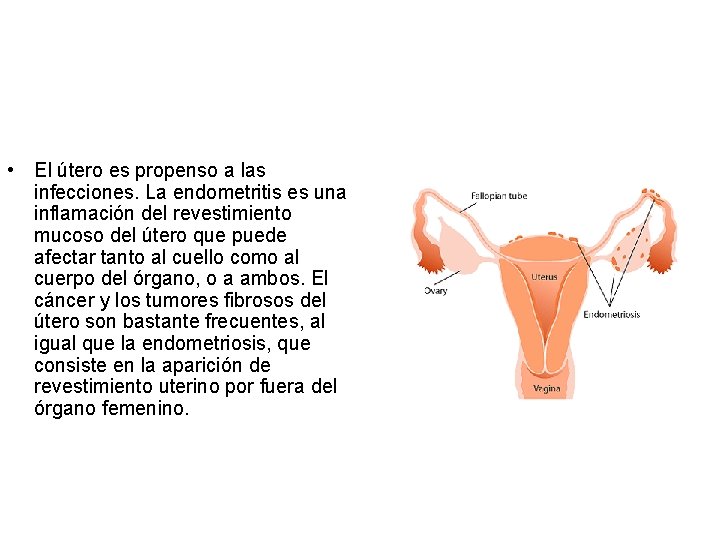  • El útero es propenso a las infecciones. La endometritis es una inflamación