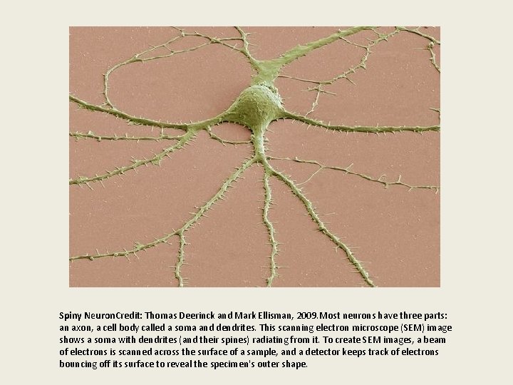 Spiny Neuron. Credit: Thomas Deerinck and Mark Ellisman, 2009. Most neurons have three parts: