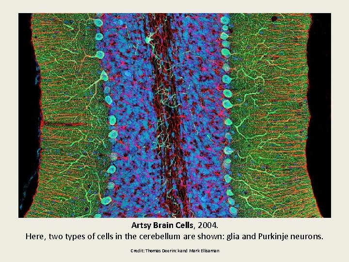 Artsy Brain Cells, 2004. Here, two types of cells in the cerebellum are shown: