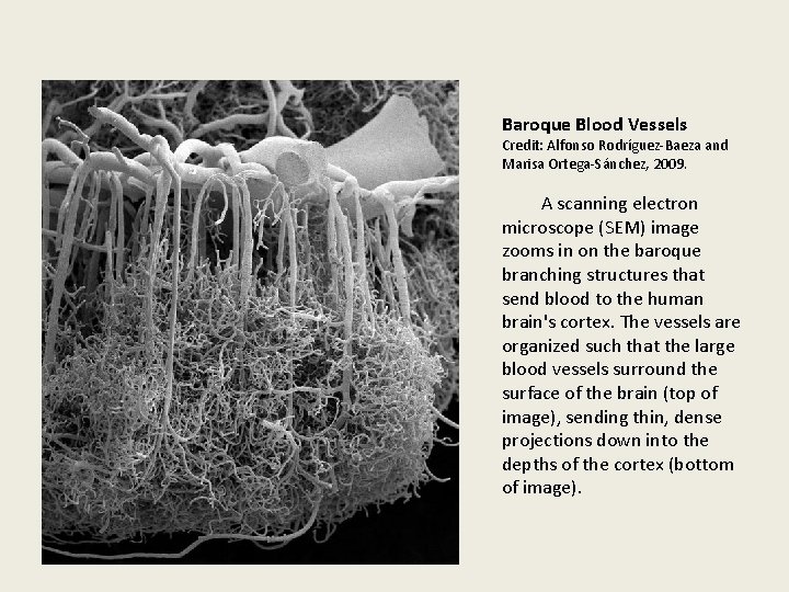 Baroque Blood Vessels Credit: Alfonso Rodríguez-Baeza and Marisa Ortega-Sánchez, 2009. A scanning electron microscope