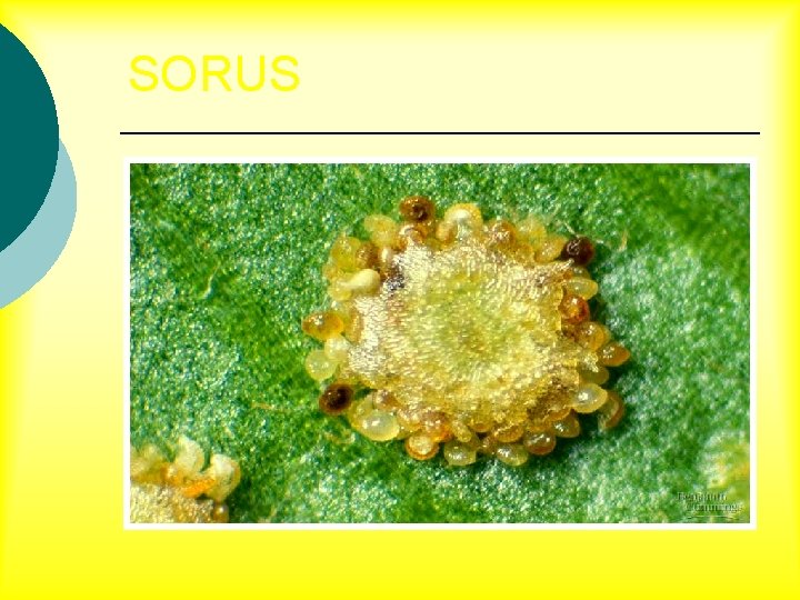 SORUS 