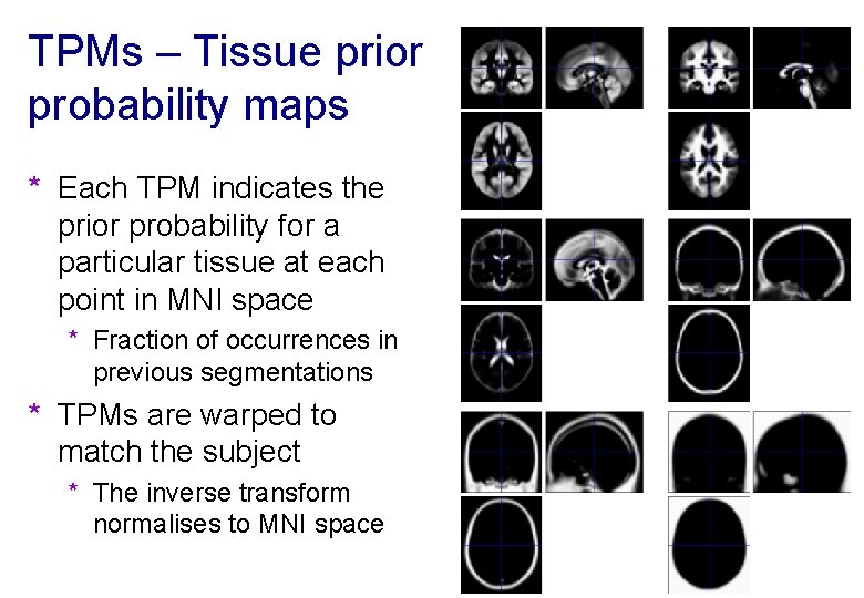 TPMs – Tissue prior probability maps * Each TPM indicates the prior probability for