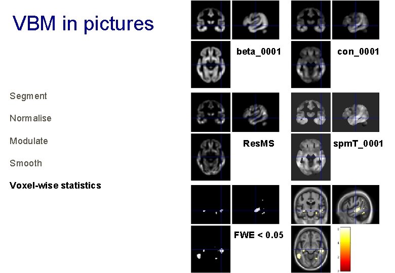 VBM in pictures beta_0001 con_0001 Res. MS spm. T_0001 Segment Normalise Modulate Smooth Voxel-wise