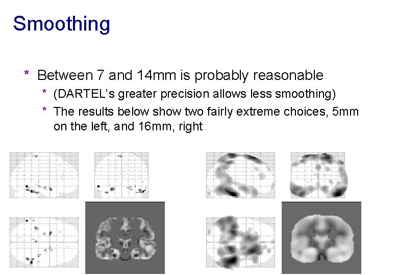 Smoothing * Between 7 and 14 mm is probably reasonable * (DARTEL’s greater precision