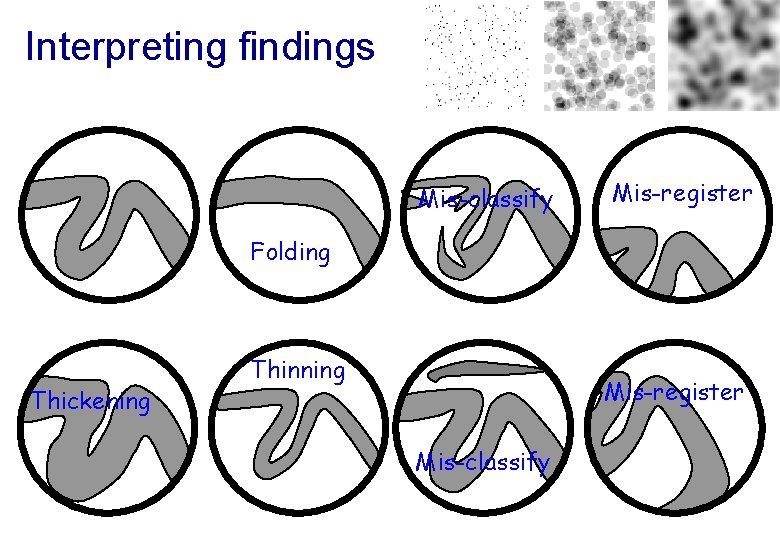 Interpreting findings Mis-classify Mis-register Folding Thickening Thinning Mis-register Mis-classify 