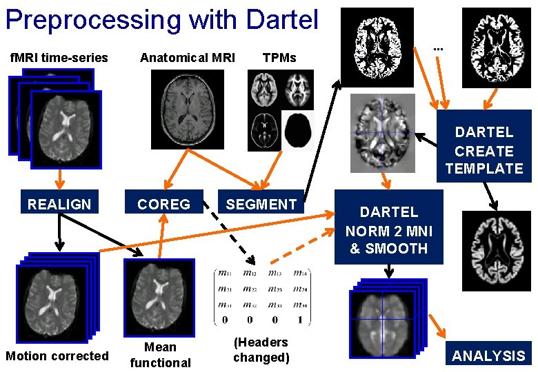 Preprocessing with Dartel f. MRI time-series Anatomical MRI . . . TPMs DARTEL CREATE