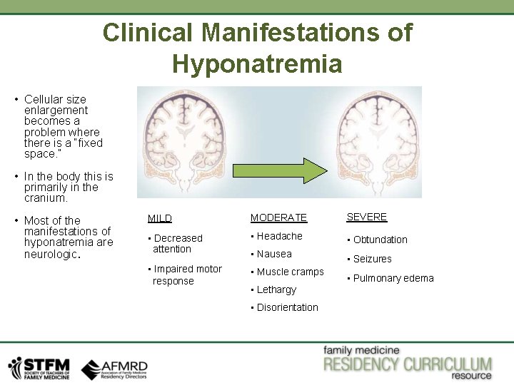 Clinical Manifestations of Hyponatremia • Cellular size enlargement becomes a problem where there is