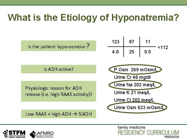 What is the Etiology of Hyponatremia? Is the patient hypo-osmolar? Is ADH active? 123