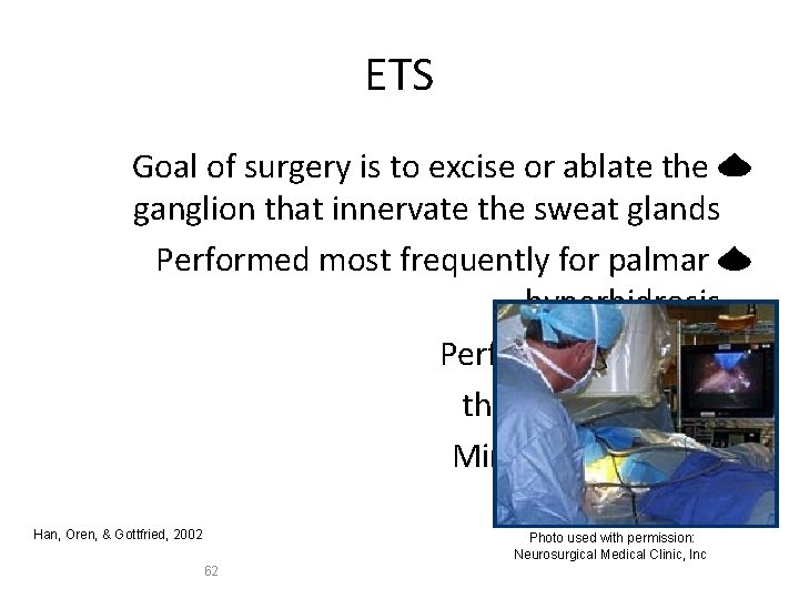 ETS Goal of surgery is to excise or ablate the ganglion that innervate the