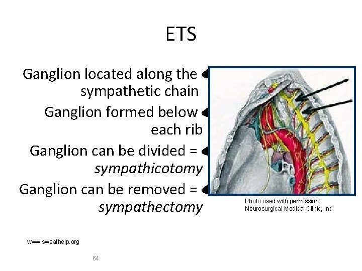 ETS Ganglion located along the sympathetic chain Ganglion formed below each rib Ganglion can