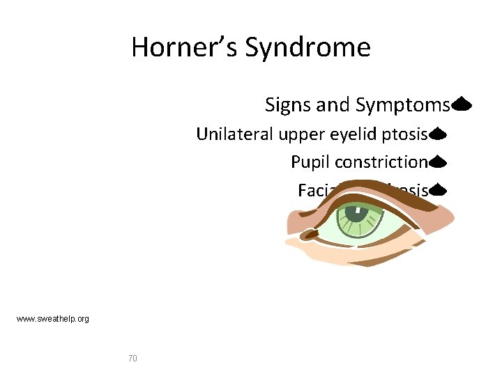 Horner’s Syndrome Signs and Symptoms Unilateral upper eyelid ptosis Pupil constriction Facial anhidrosis www.