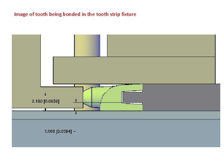Image of tooth being bonded in the tooth strip fixture 