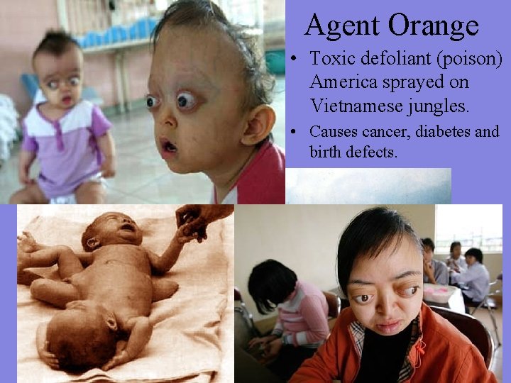 Agent Orange • Toxic defoliant (poison) America sprayed on Vietnamese jungles. • Causes cancer,