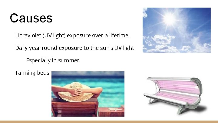Causes Ultraviolet (UV light) exposure over a lifetime. Daily year-round exposure to the sun’s