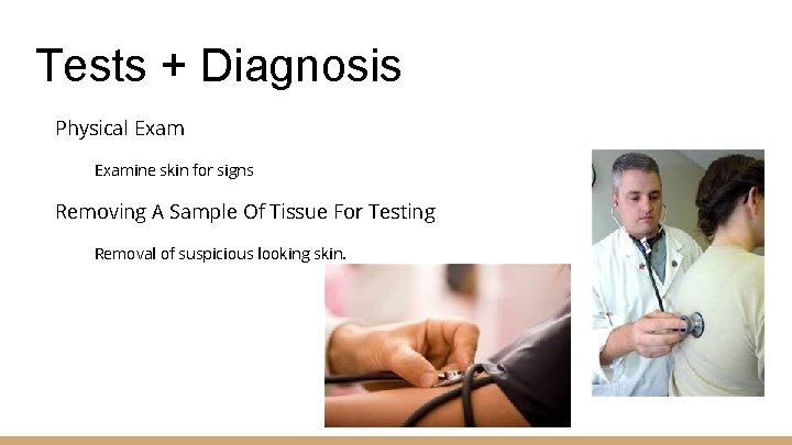 Tests + Diagnosis Physical Examine skin for signs Removing A Sample Of Tissue For