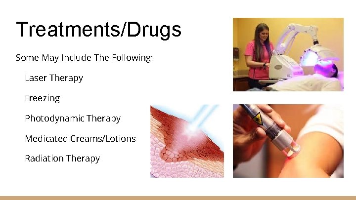 Treatments/Drugs Some May Include The Following: Laser Therapy Freezing Photodynamic Therapy Medicated Creams/Lotions Radiation