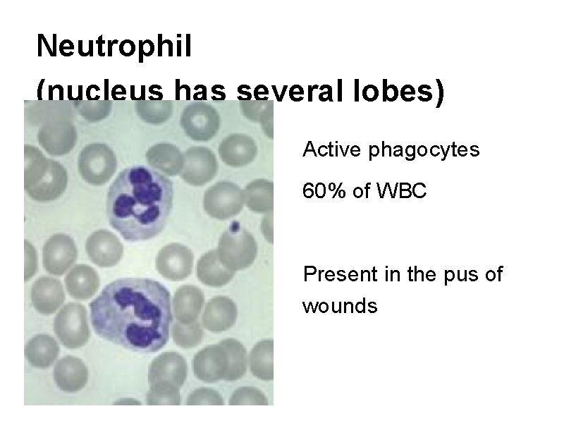 Neutrophil (nucleus has several lobes) Active phagocytes 60% of WBC Present in the pus