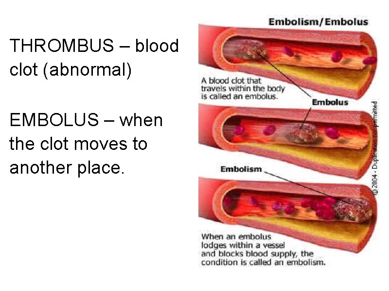 THROMBUS – blood clot (abnormal) EMBOLUS – when the clot moves to another place.