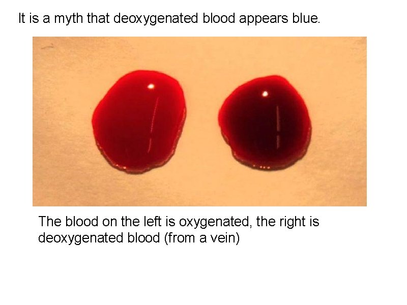 It is a myth that deoxygenated blood appears blue. The blood on the left