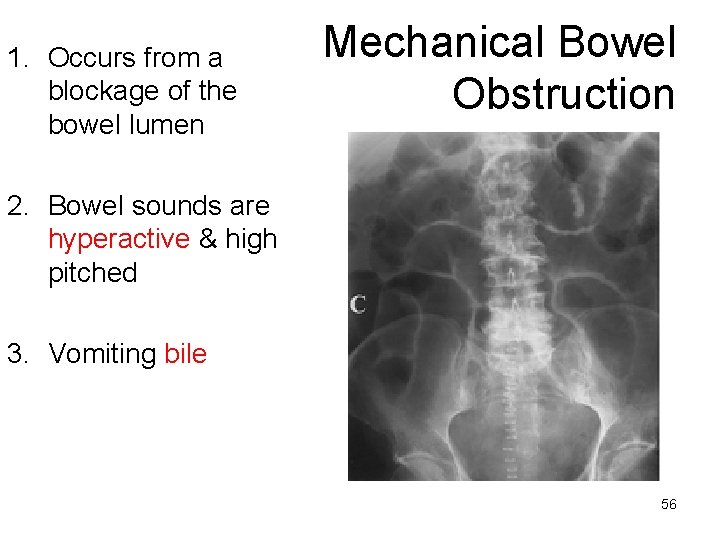 1. Occurs from a blockage of the bowel lumen Mechanical Bowel Obstruction 2. Bowel
