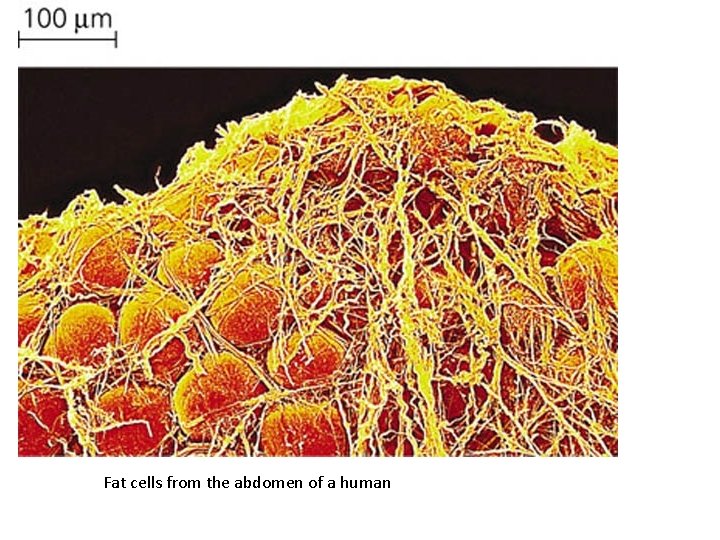 Fat cells from the abdomen of a human 