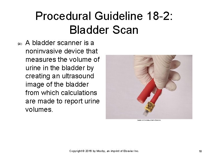 Procedural Guideline 18 -2: Bladder Scan A bladder scanner is a noninvasive device that