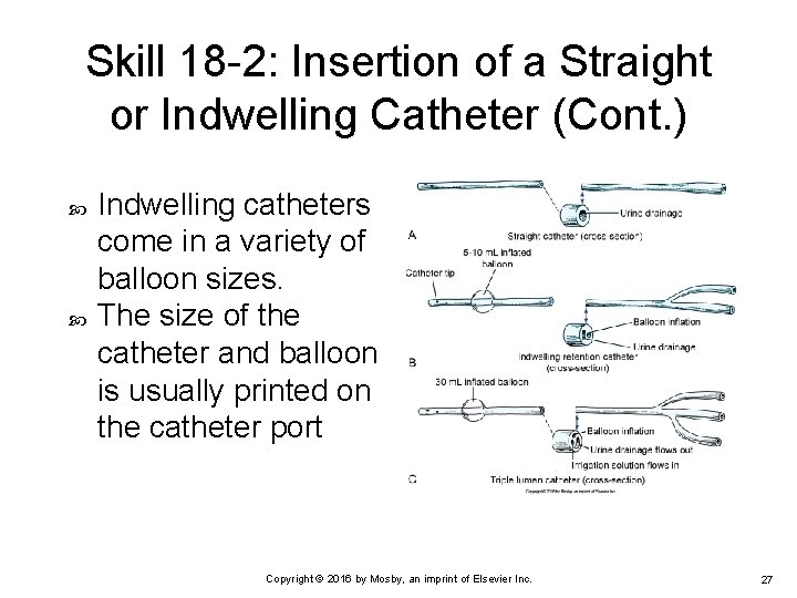 Skill 18 -2: Insertion of a Straight or Indwelling Catheter (Cont. ) Indwelling catheters