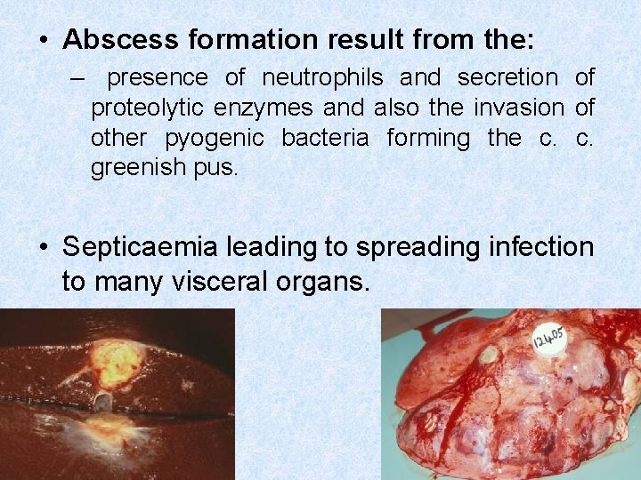  • Abscess formation result from the: – presence of neutrophils and secretion of