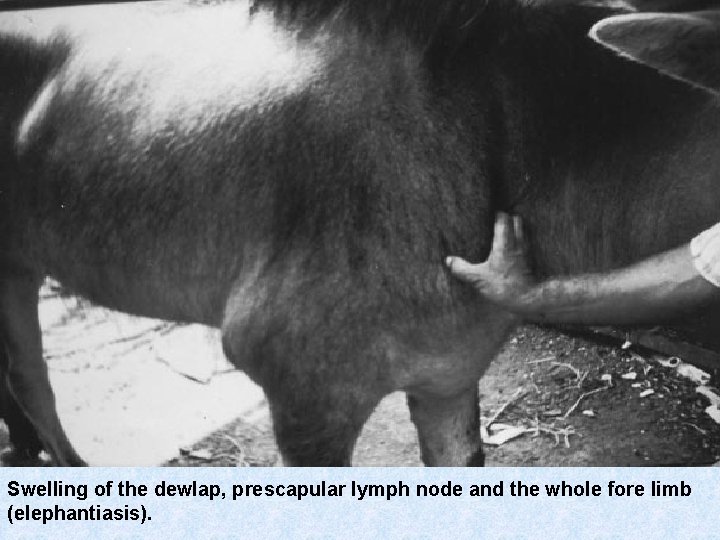 Swelling of the dewlap, prescapular lymph node and the whole fore limb (elephantiasis). 