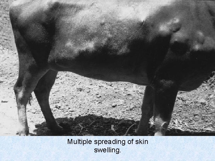 Multiple spreading of skin swelling. 
