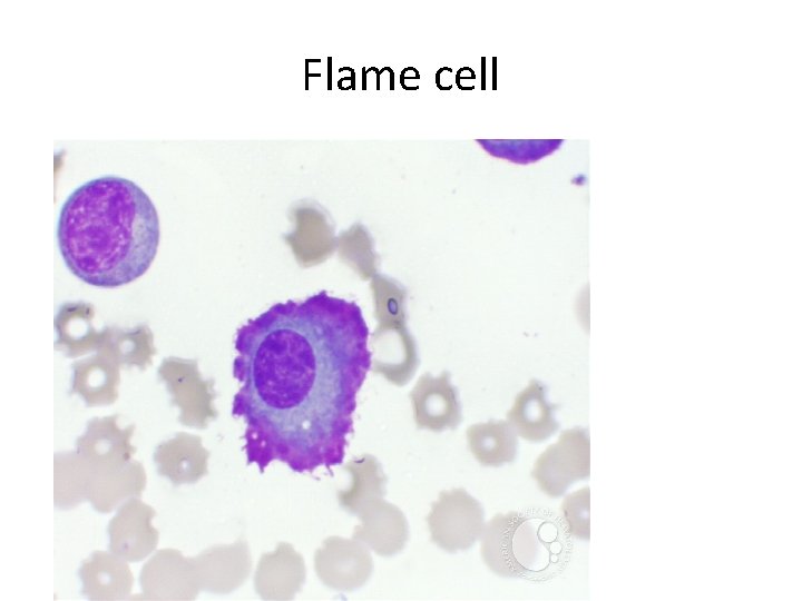 Flame cell 