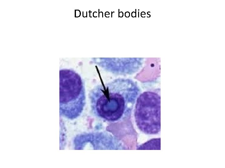 Dutcher bodies 