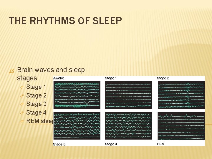 THE RHYTHMS OF SLEEP Brain waves and sleep stages Stage 1 Stage 2 Stage