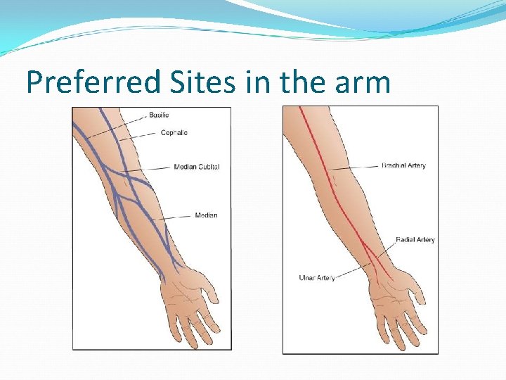 Preferred Sites in the arm 