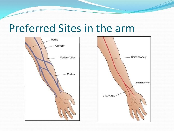Preferred Sites in the arm 