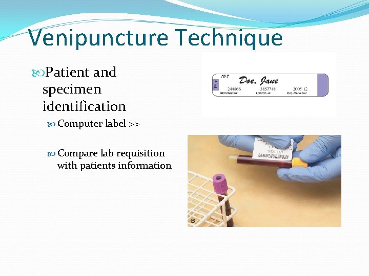 Venipuncture Technique Patient and specimen identification Computer label >> Compare lab requisition with patients