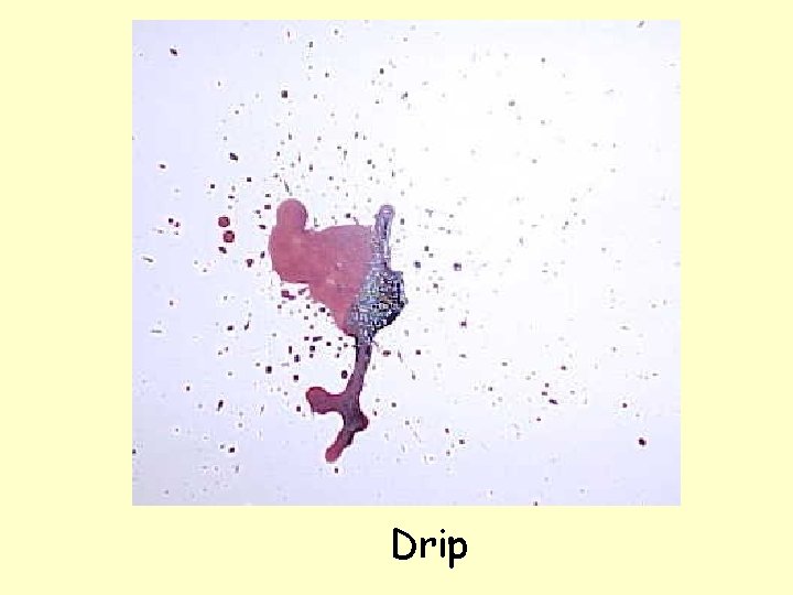 Drip 