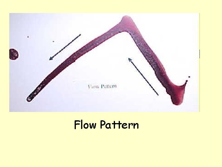 Flow Pattern 
