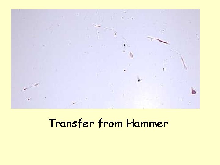 Transfer from Hammer 