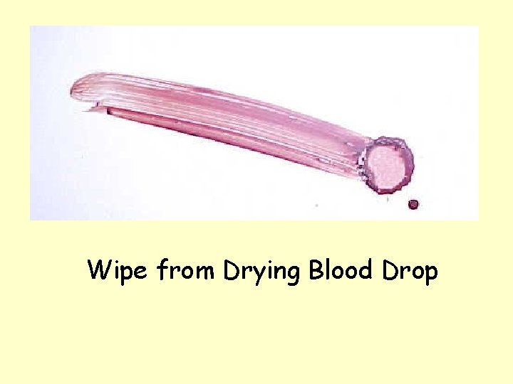 Wipe from Drying Blood Drop 