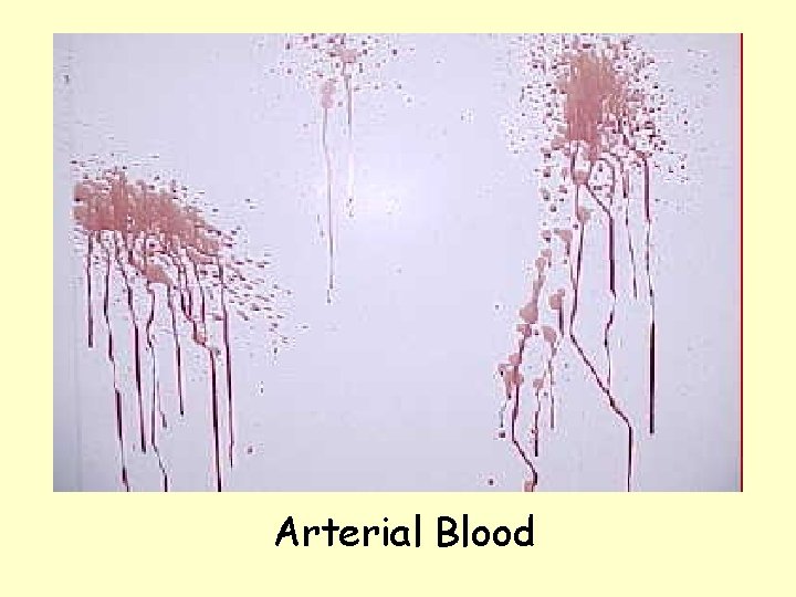 Arterial Blood 