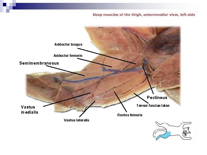 Adductor longus Adductor femoris Semimembranosus Pectineus Tensor fasciae latae Vastus medialis Rectus femoris Vastus