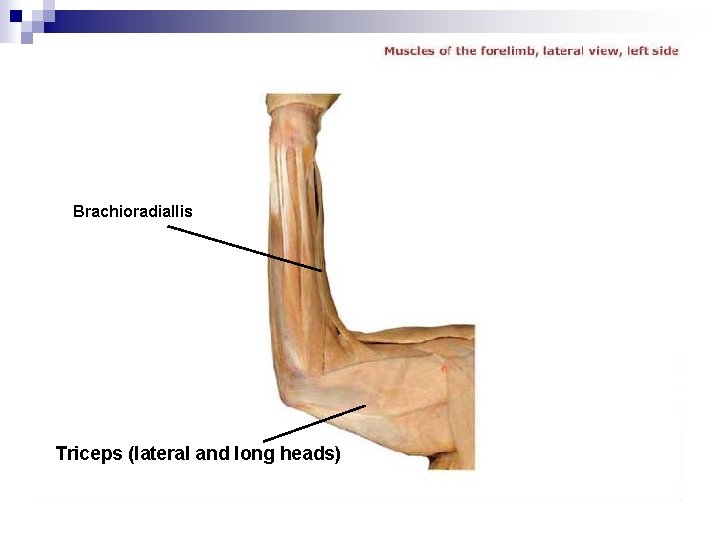Brachioradiallis Triceps (lateral and long heads) 