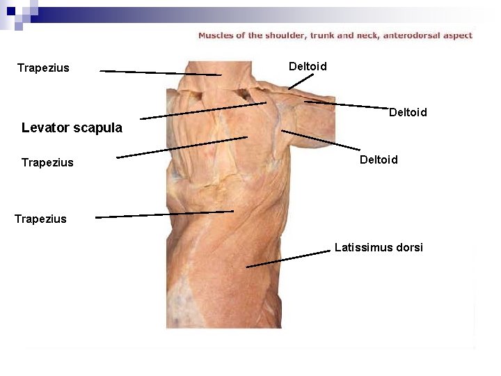 Trapezius Deltoid Levator scapula Trapezius Deltoid Trapezius Latissimus dorsi 
