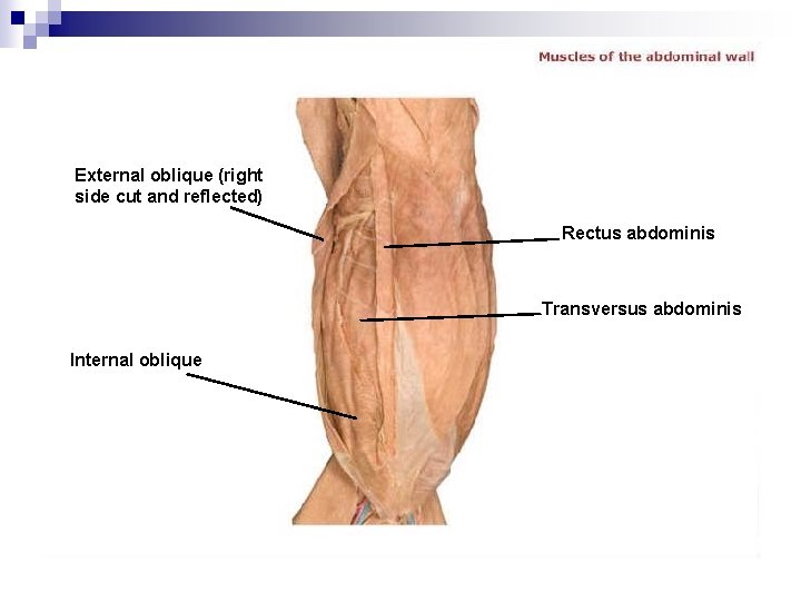 External oblique (right side cut and reflected) Rectus abdominis Transversus abdominis Internal oblique 