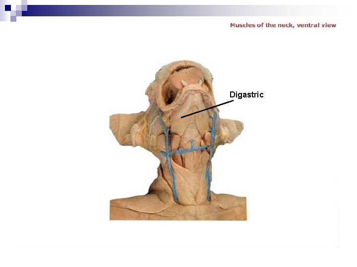 Digastric 